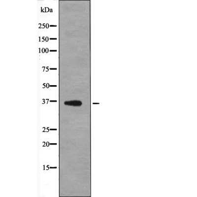 MCL1 (Phospho-Thr163) Antibody