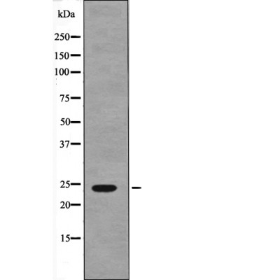 NACA (Phospho-Ser43) Antibody