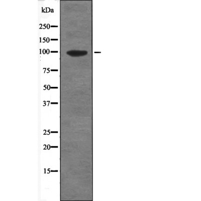 Progesterone Receptor (Phospho-Ser345) Antibody