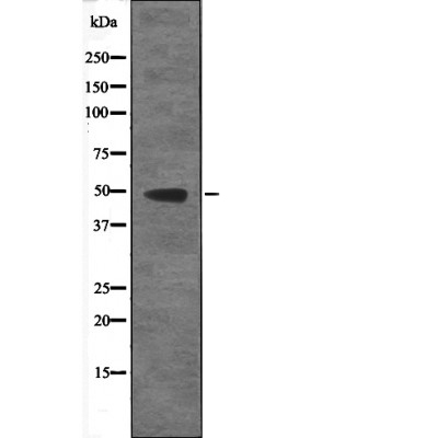 RAD23 (Phospho-Ser357) Antibody