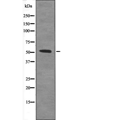 TAB1 (Phospho-Ser438) Antibody