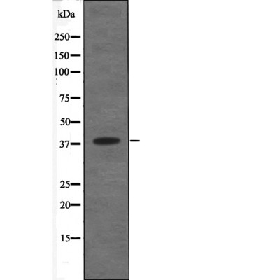 C5AR1 (Phospho-Ser334) Antibody