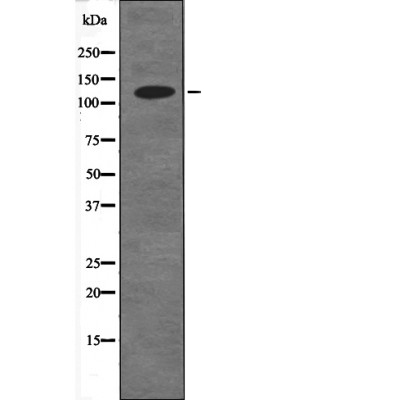 CDH1 (Phospho-Ser844) Antibody