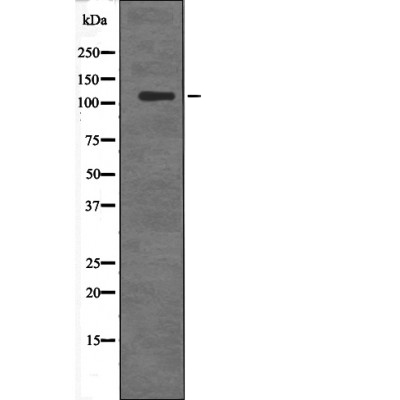 DDEF2 (Phospho-Ser701) Antibody