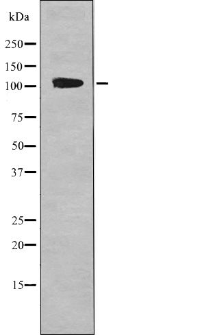 EPHA1 (Phospho-Tyr599) Antibody