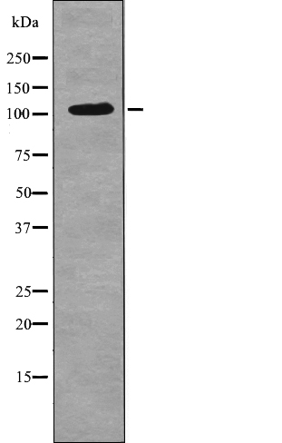 EPHA3 (Phospho-Tyr602) Antibody