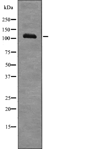 EPHA7 (Phospho-Tyr608) Antibody