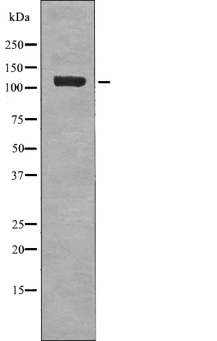 EPHB1/2 (Phospho-Tyr778/Tyr780) Antibody