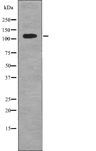 EPHB6 (Phospho-Tyr636) Antibody