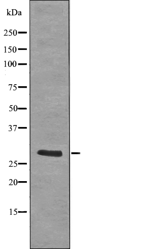 LAT (Phospho-Tyr255) Antibody