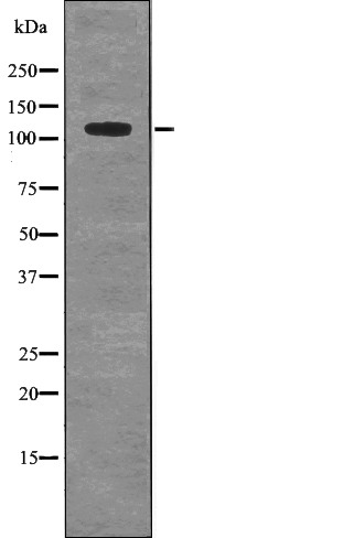 MYPT1 (Phospho-Ser507) Antibody