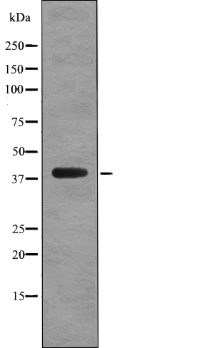 CD88 (Phospho-Ser327) Antibody