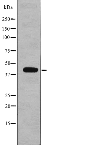 eIF2B (Phospho-Ser67) Antibody