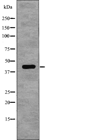 NDRG1 (Phospho-Thr346) Antibody