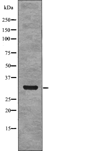 NPM (Phospho-Ser4) Antibody