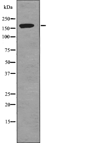 TOP2A (Phospho-Ser1337) Antibody