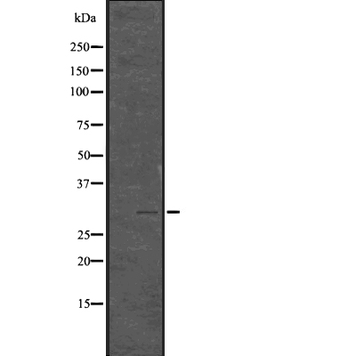 Histone H1.3 (Phospho-Thr17) +H1.4 (Phospho-Thr17) Antibody 