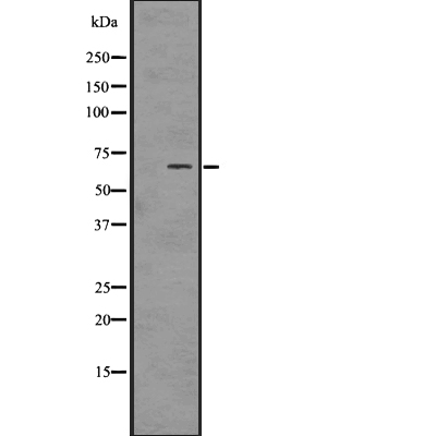 PAK1/2/3 (Phospho-Ser144+Ser141+Ser139) Antibody