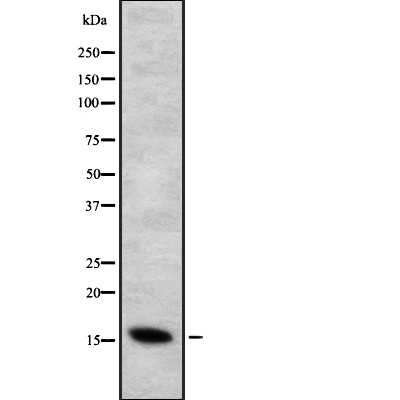 CYB5B Antibody