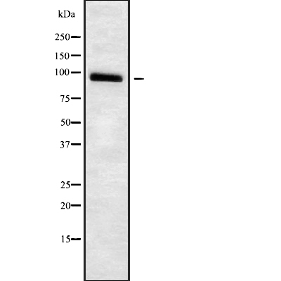 ADAM23 Antibody