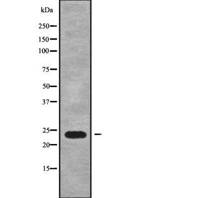 RAB15 Antibody