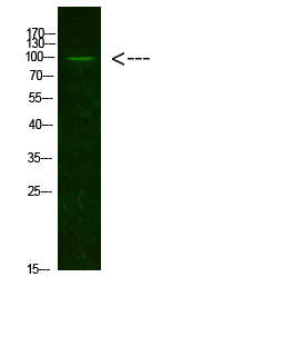 AR(Acetyl-K631) Polyclonal Antibody