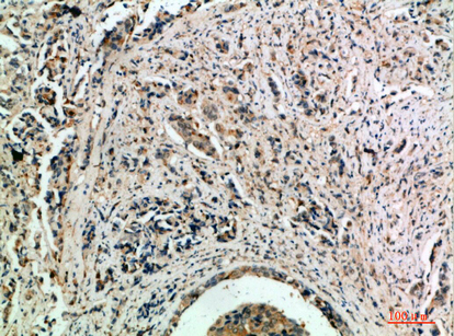 TLE1/2/3/4 Polyclonal Antibody