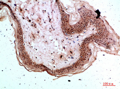 Tryptase-3 Polyclonal Antibody