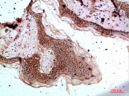 Tryptase-3 Polyclonal Antibody