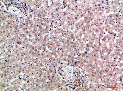 MIA2 Polyclonal Antibody