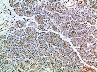 MIA2 Polyclonal Antibody