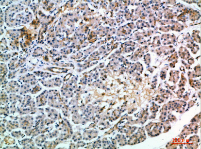 MIA2 Polyclonal Antibody