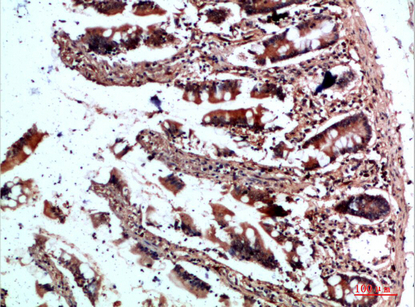 CYFIP2 Polyclonal Antibody