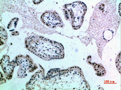 NOP56 Polyclonal Antibody