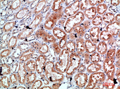 Perforin 1 Polyclonal Antibody