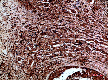 Ret Polyclonal Antibody