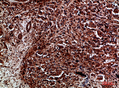 Ret Polyclonal Antibody