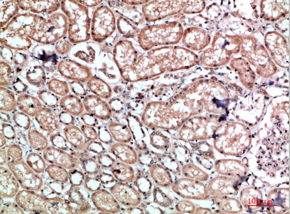 Caldesmon Polyclonal Antibody