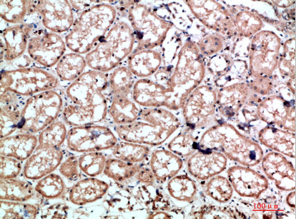 Caldesmon Polyclonal Antibody