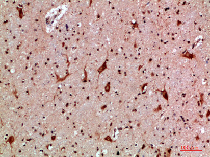 MBL-C Polyclonal Antibody