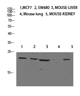 Calcitonin Polyclonal Antibody