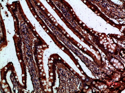 I-FABP Polyclonal Antibody