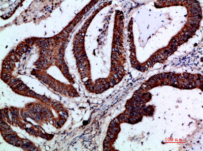 Gremlin-2 Polyclonal Antibody