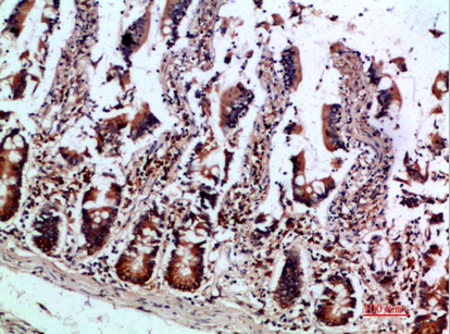 IL-12B p40 Polyclonal Antibody