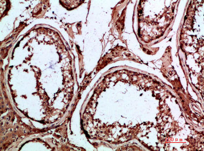 INSL3 Polyclonal Antibody