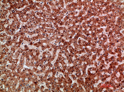 ANG I Polyclonal Antibody