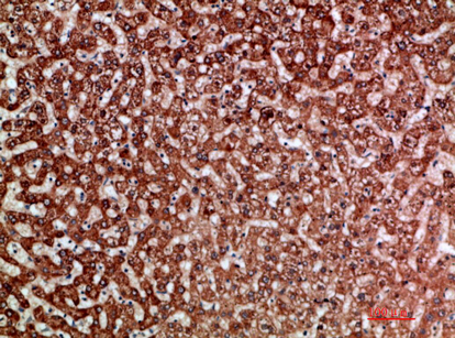 ANG I Polyclonal Antibody