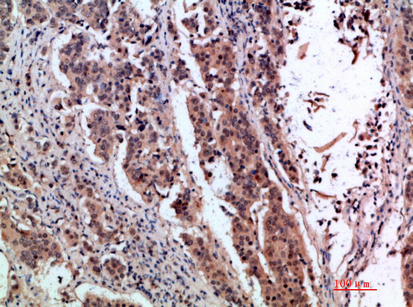 pS2 Polyclonal Antibody