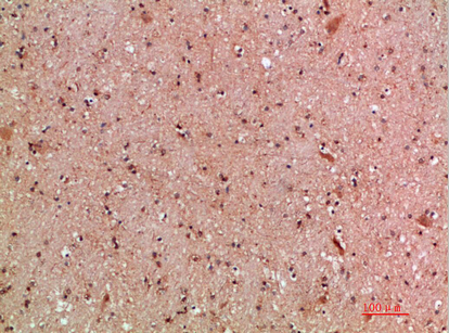 MLL Polyclonal Antibody