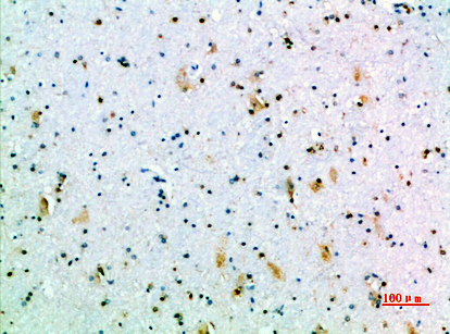 GH Polyclonal Antibody